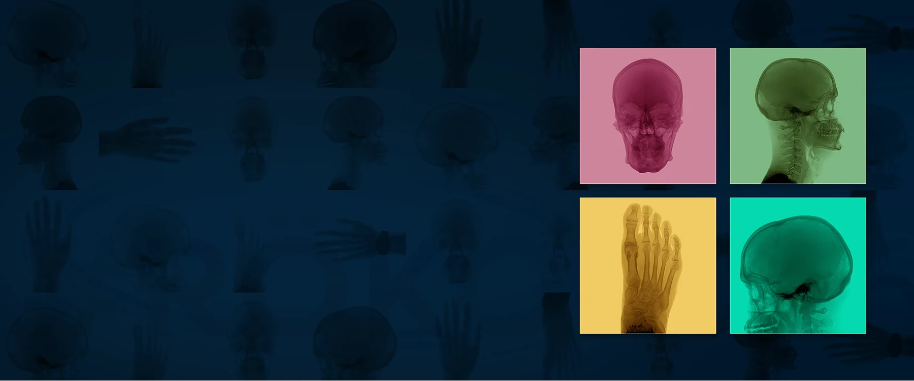 Radiologie grenzenlos 107. Deutscher Röntgenkongress