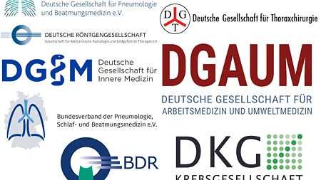 DRG.de: Durchbruch auf dem Weg zu einem Früherkennungsprogramm für Lungenkrebs