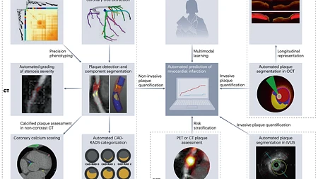 DRG.de: Roadmap zeigt den Einsatz künstlicher Intelligenz in der radiologischen Herzbildgebung