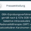 GBA-Erprobungsverfahren gemäß nach § 137e SGB V: Selektive intravaskuläre Radionuklidtherapie (SIRT) von hepatozellulären Karzinomen (HCC)